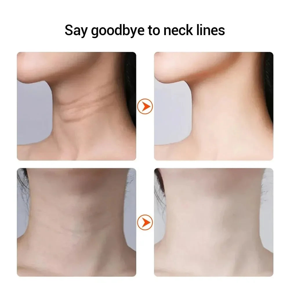 Neck &amp; Face Lifting Device